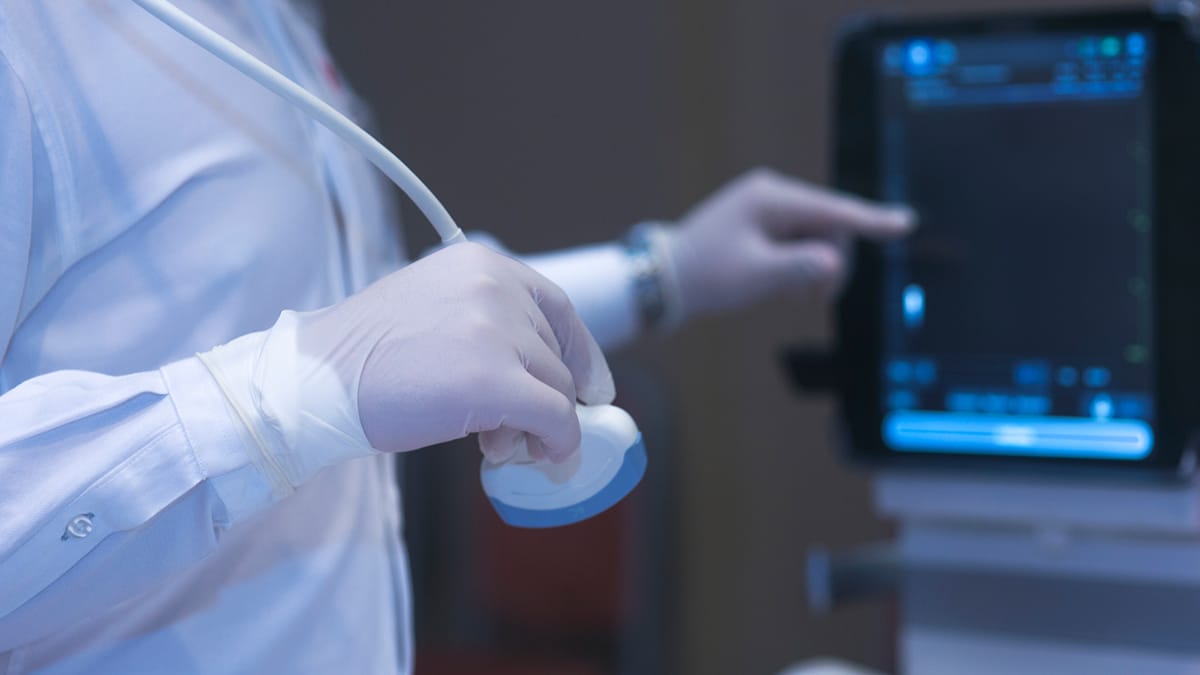 acciones de inconstitucionalidad concepción